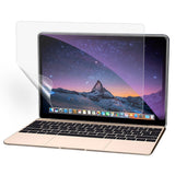 MacBook 12 PET Protective Film - Transparent