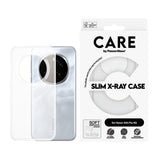 CARE by PanzerGlass Honor 400 Pro Fashionable Transparent X-Ray Soft Basic Case - Transparent