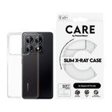 CARE by PanzerGlass Xiaomi 14T Pro FASHION X-Ray Soft Basic Case - Transparent