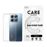 CARE by PanzerGlass Xiaomi 14T FASHION X-Ray Soft Basic Case - Transparent